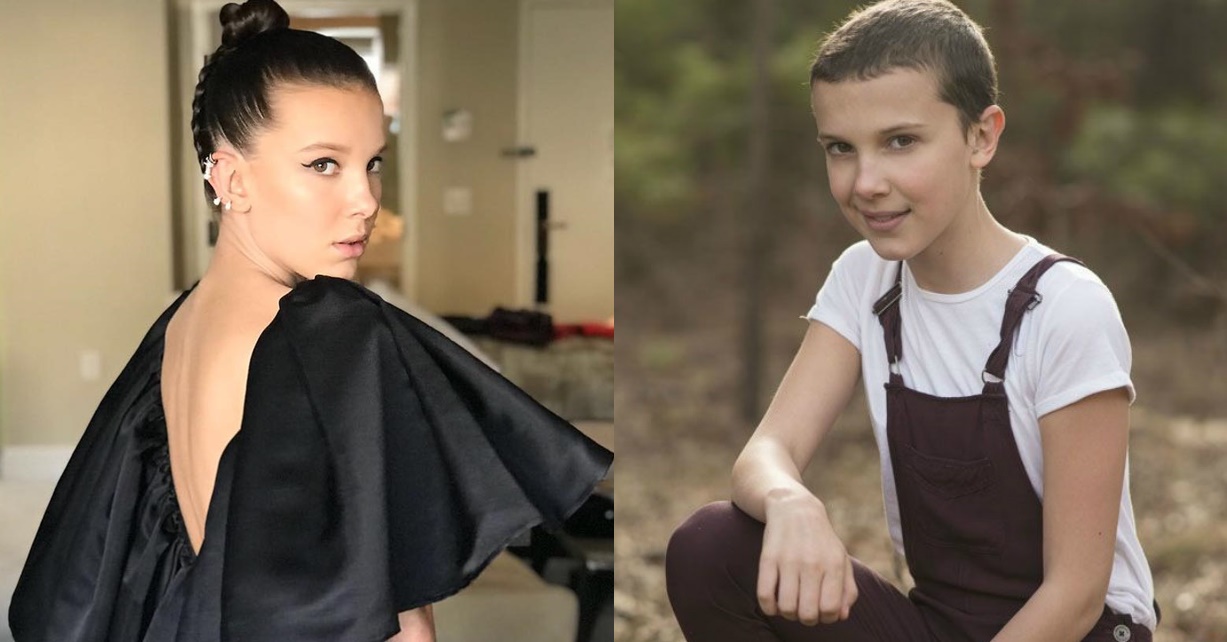 ‘Você não precisa de cabelo para ser bonita’, diz Millie Bobby Brown