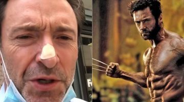 Hugh Jackman apavora fãs após biópsia no nariz, anos após se curar do câncer