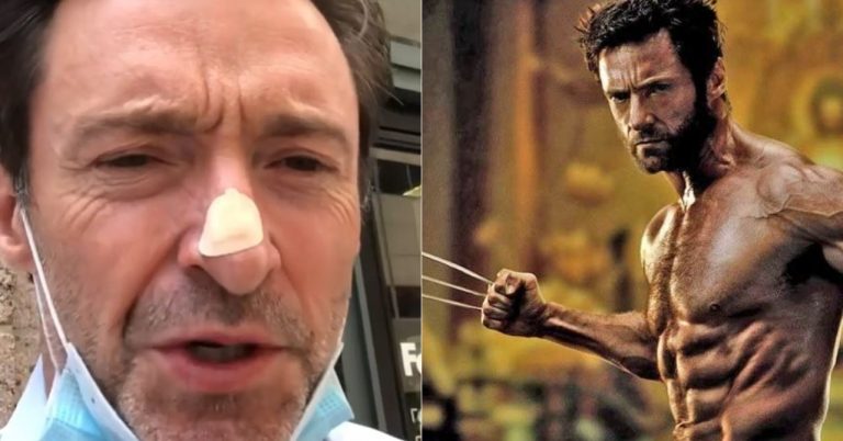 hugh jackman biopsia wolverine