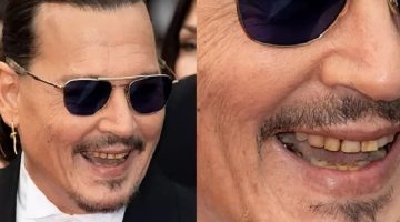 O que aconteceu com os dentes de Johnny Depp? Dentista tenta explicar