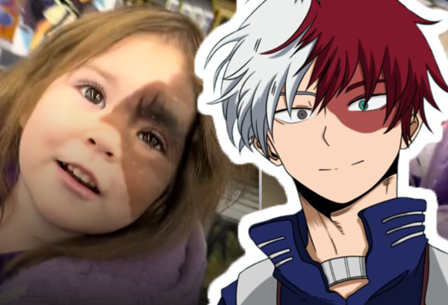 Menina se encanta ao ver semelhança com Shoto Todoroki e vídeo iiraliza